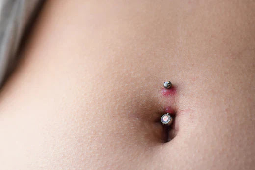 rejecting navel piercing